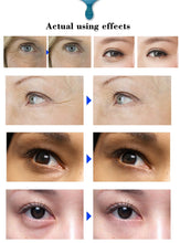 Load image into Gallery viewer, Tea Tree Six Peptide Eye  Anti-Wrinkle Snail serum